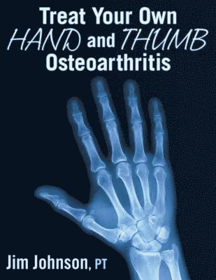 Jim Johnson - Treat Your Own Hand and Thumb Osteoarthritis, Häftad