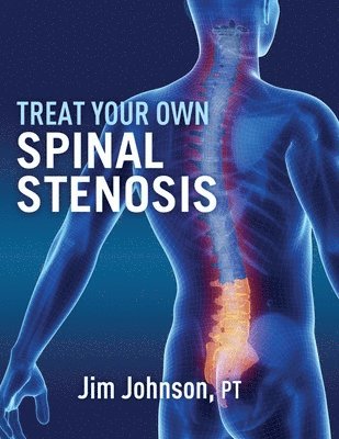Jim Johnson - Treat Your Own Spinal Stenosis, Häftad