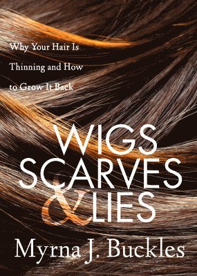 bokomslag Wigs, Scarves & Lies