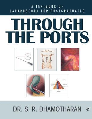 Through the Ports: A Textbook of Laparoscopy for Postgraduates 1