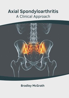 Axial Spondyloarthritis: A Clinical Approach 1