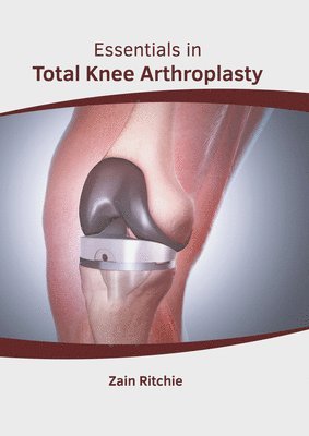 bokomslag Essentials in Total Knee Arthroplasty