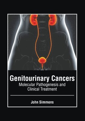 Genitourinary Cancers: Molecular Pathogenesis and Clinical Treatment 1