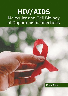 bokomslag Hiv/Aids: Molecular and Cell Biology of Opportunistic Infections