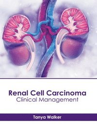 bokomslag Renal Cell Carcinoma: Clinical Management