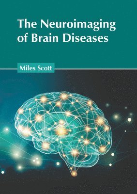 The Neuroimaging of Brain Diseases 1