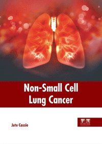 bokomslag Non-Small Cell Lung Cancer