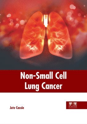 Non-Small Cell Lung Cancer 1