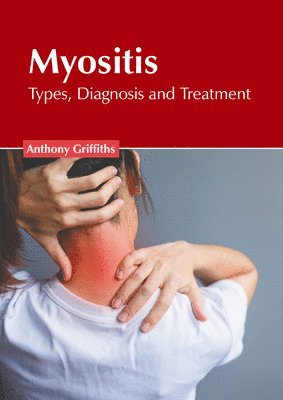 Myositis: Types, Diagnosis and Treatment 1