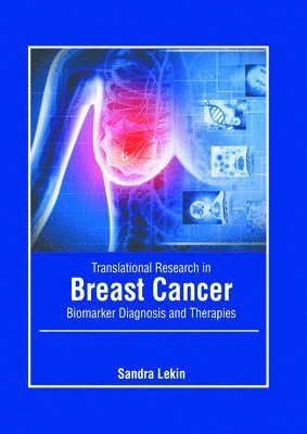 Sandra Lekin - Translational Research in Breast Cancer: Biomarker Diagnosis and Therapies, Inbunden