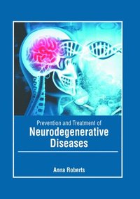 bokomslag Prevention and Treatment of Neurodegenerative Diseases