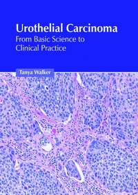 bokomslag Urothelial Carcinoma: From Basic Science to Clinical Practice