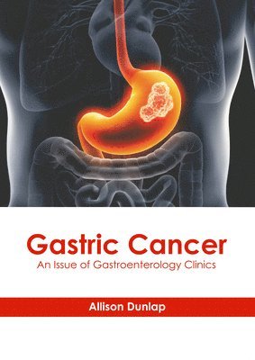 bokomslag Gastric Cancer