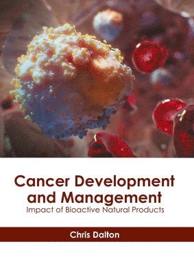 Chris Dalton - Cancer Development and Management: Impact of Bioactive Natural Products, Inbunden