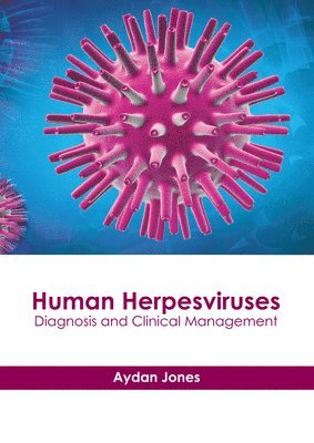 bokomslag Human Herpesviruses: Diagnosis and Clinical Management