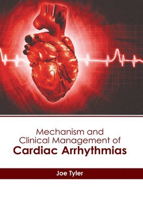 bokomslag Mechanism and Clinical Management of Cardiac Arrhythmias