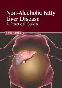 bokomslag Non-Alcoholic Fatty Liver Disease: A Practical Guide