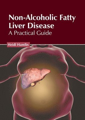 Non-Alcoholic Fatty Liver Disease: A Practical Guide 1