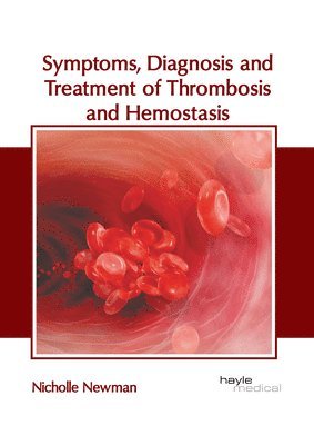 Symptoms, Diagnosis and Treatment of Thrombosis and Hemostasis 1
