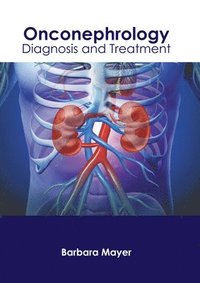 bokomslag Onconephrology: Diagnosis and Treatment
