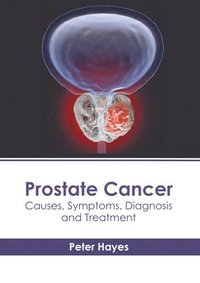 bokomslag Prostate Cancer: Causes, Symptoms, Diagnosis and Treatment