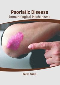 bokomslag Psoriatic Disease: Immunological Mechanisms