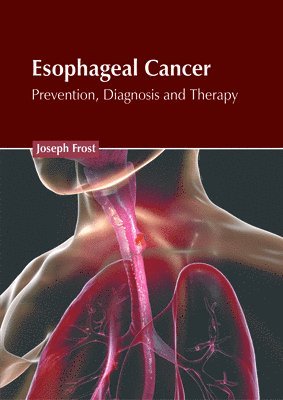 bokomslag Esophageal Cancer: Prevention, Diagnosis and Therapy