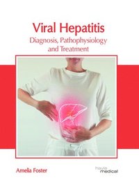 bokomslag Viral Hepatitis: Diagnosis, Pathophysiology and Treatment