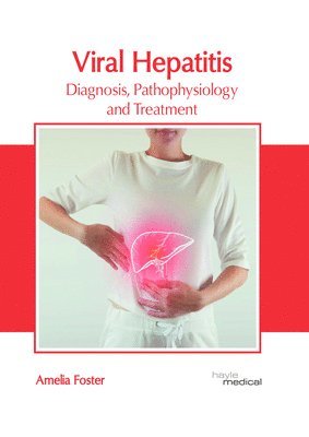 Viral Hepatitis: Diagnosis, Pathophysiology and Treatment