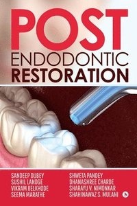 bokomslag Post Endodontic Restoration