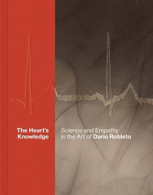 Heart’s Knowledge: Science and Empathy in the Art of Dario Robleto