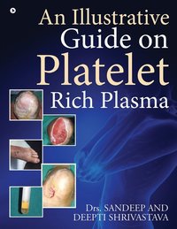 bokomslag An Illustrative Guide on Platelet Rich Plasma