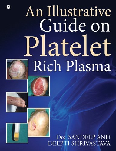 bokomslag Illustrative Guide on Platelet Rich Plasma
