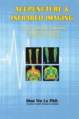 bokomslag Acupuncture and Infrared Imaging