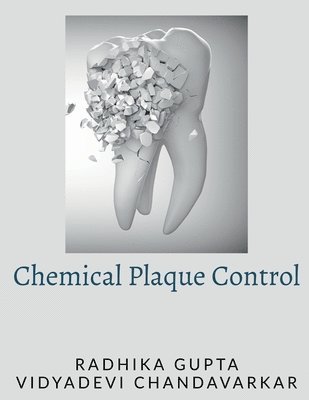 Radhika Gupta - Chemical Plaque Control, Häftad