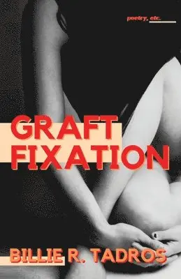 Billie Tadros - Graft Fixation, Häftad. Tillgänglighet: Lägg i varukorg