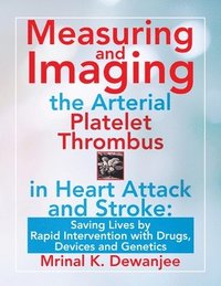 bokomslag Measuring and Imaging the Arterial Platelet Thrombus in Heart Attack and Stroke