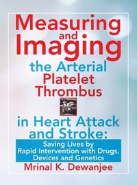 bokomslag Measuring and Imaging the Arterial Platelet Thrombus in Heart Attack and Stroke