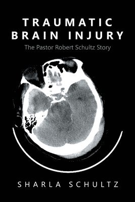 bokomslag Traumatic Brain Injury