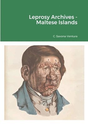 bokomslag Leprosy Archives - Maltese Islands