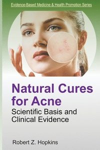 bokomslag Natural Cures for Acne: Scientific Basis and Clinical Evidence