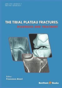bokomslag The Tibial Plateau Fractures: Diagnosis and Treatmment