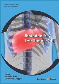 bokomslag Nonalcoholic Fatty Liver Disease (NAFLD)