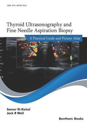 bokomslag Thyroid Ultrasonography and Fine Needle Aspiration Biopsy: A Practical Guide and Picture Atlas