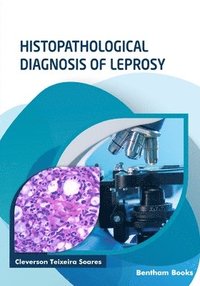 bokomslag Histopathological Diagnosis Of Leprosy