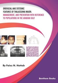 bokomslag Orofacial and Systemic Features of Thalassemia Major