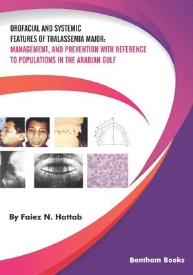 Orofacial and Systemic Features of Thalassemia Major 1