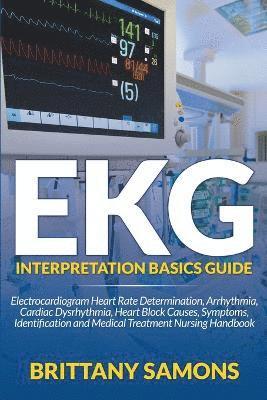 EKG Interpretation Basics Guide 1