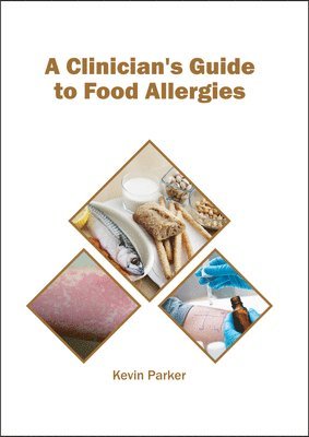 Kevin Parker - Clinician's Guide to Food Allergies, Inbunden