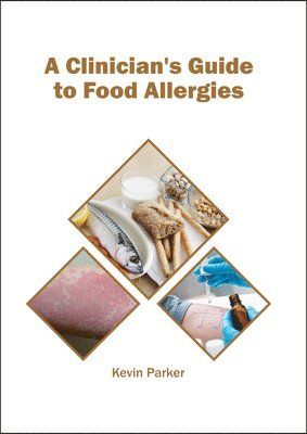 A Clinician's Guide to Food Allergies 1